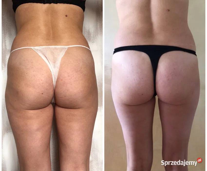BodyLab Asclepion