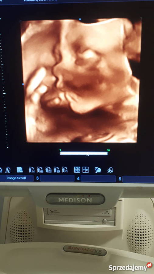 APARAT USG MEDISON X8 4 sondy Sprzęt medyczny