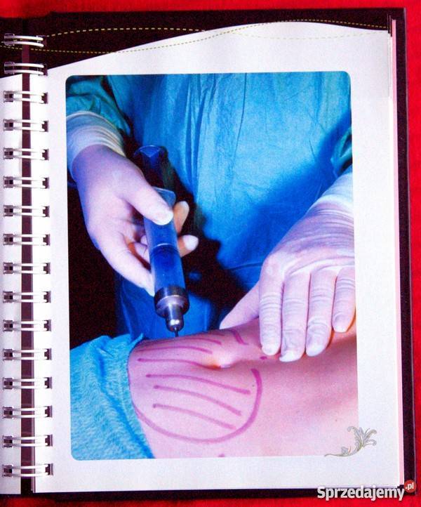 Chirurgia kosmetyczna Cosmetic Surgery Pozostałe Gliwice sprzedam