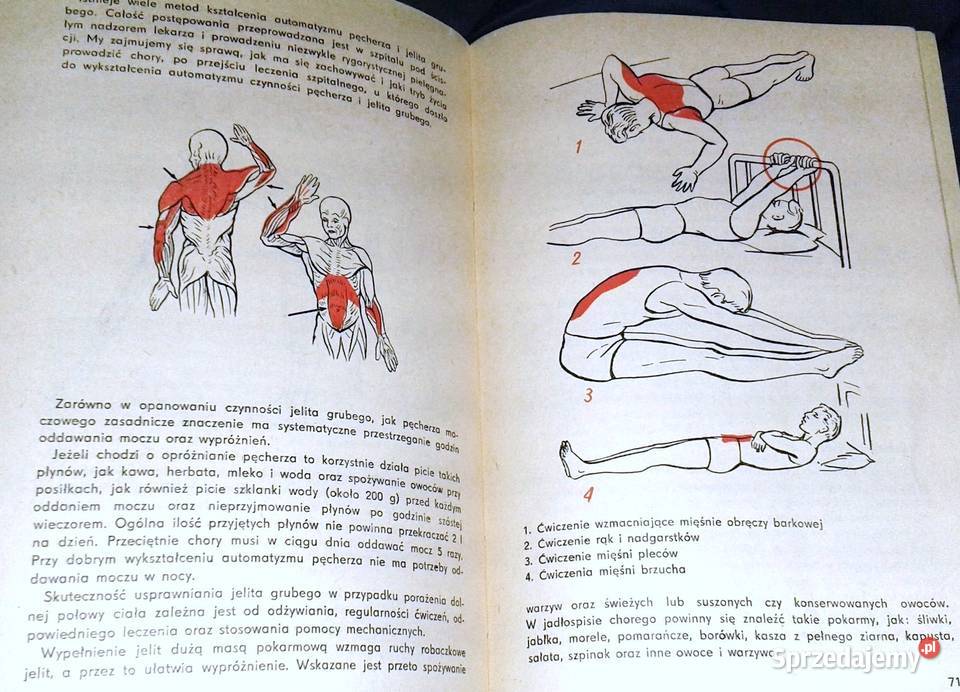 Złamania kości i zwichnięcia stawów J Babecki A Pozostałe Chełm