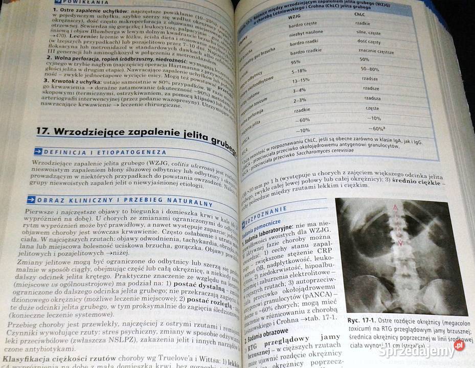 Choroby wewnętrzne Andrzej Szczeklik Piotr Chełm sprzedam