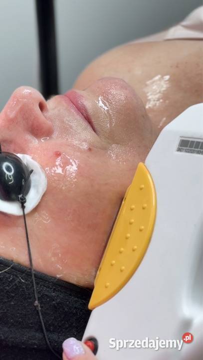 Fotoodmladzanie ipl Chorzów