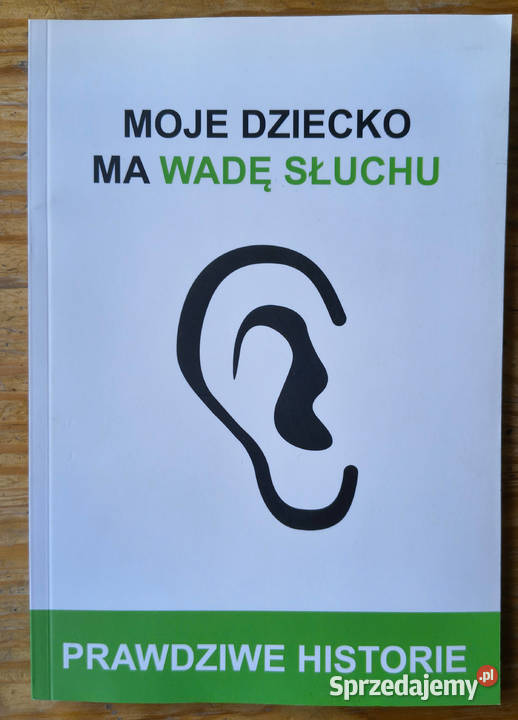 Moje dziecko ma wadę słuchu Agnieszka Kaproń Sosnowiec