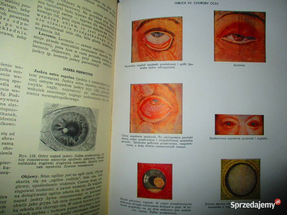 Mała encyklopedia zdrowia 1963 medycyna zdrowie Łódź sprzedam