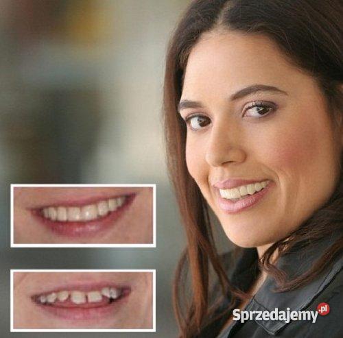 RÓWNE I WYBIELONE ZĘBY W PIĘĆ MINUT Zdrowie i Uroda Szczecin
