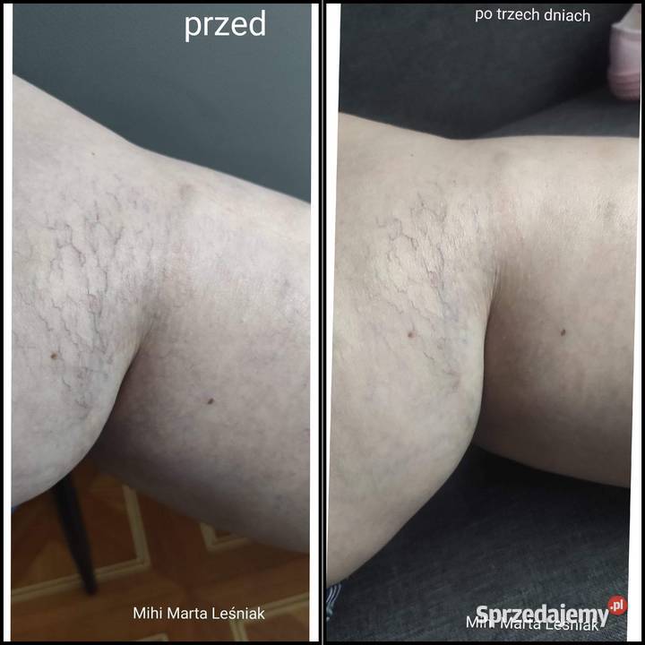 Kremy do twarzy z CBD na Dzień i na Noc Dla kobiet Hajnówka