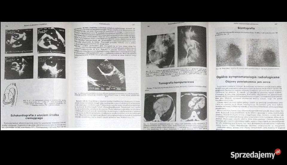 Zarys kardiologii Henryk Chlebus Włodzimierz Chełm