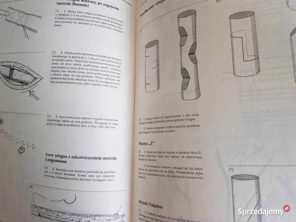 Chirurgia operacyjna atlas zabiegów medycyna Książki naukowe i popularnonaukowe świętokrzyskie