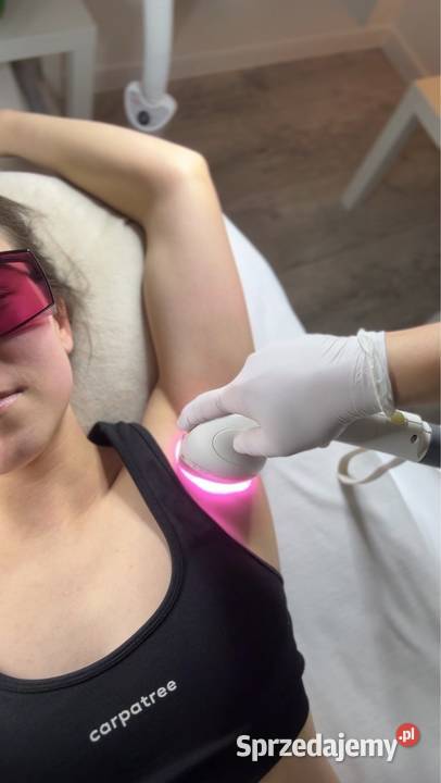 Depilacja laserowa Mosty Kosakowo