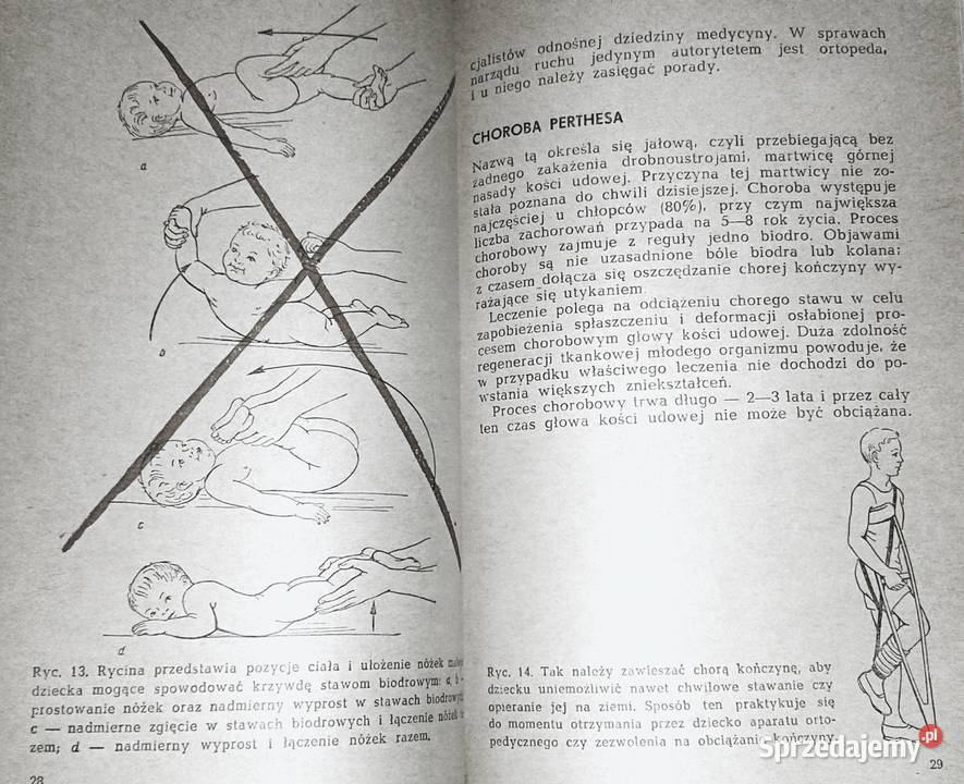 Chcę mieć zdrowe nogi Artur Dziak miękka lubelskie Chełm