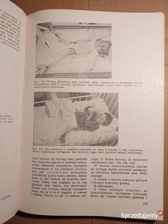 Fizjoterapia Weissa Pozostałe Łódź