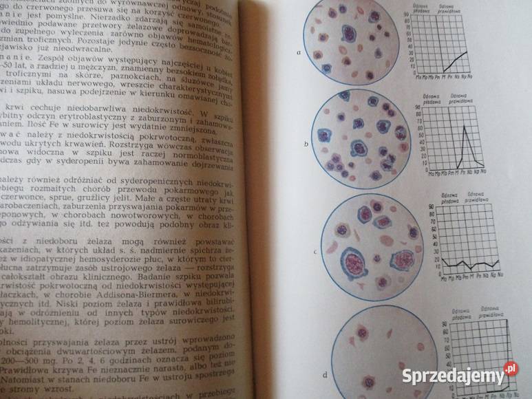 Choroby krwi i narządów krwiotwórczych medycyna Łódź