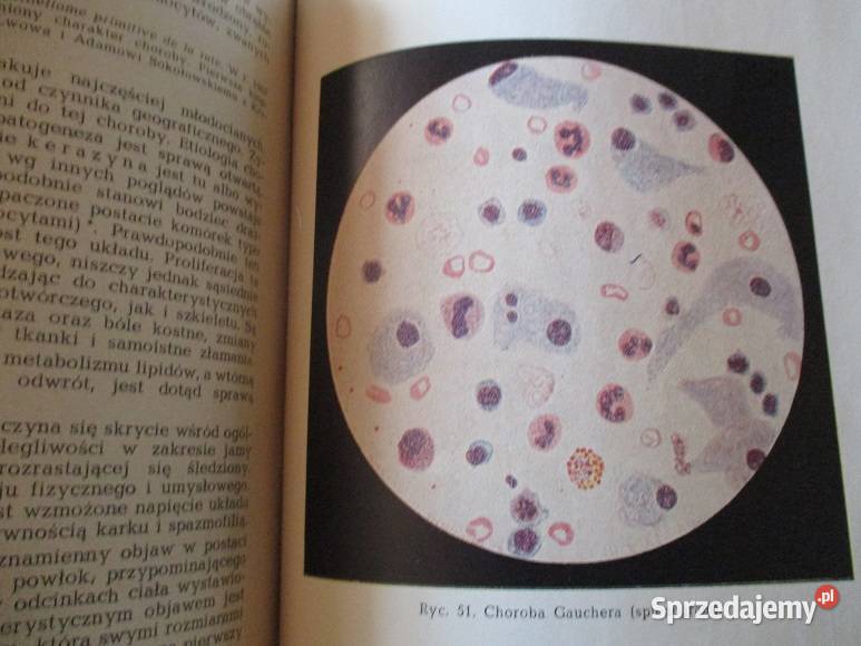 Choroby krwi i narządów krwiotwórczych medycyna Łódź sprzedam