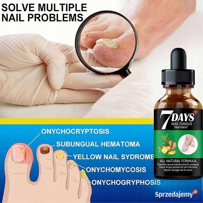 7days Serum przeciw grzybicy paznokci mazowieckie Płock sprzedam