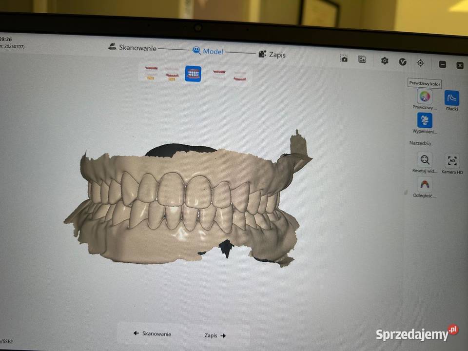 Skaner wewnątrzustyny Runyes 3DS Wrocław