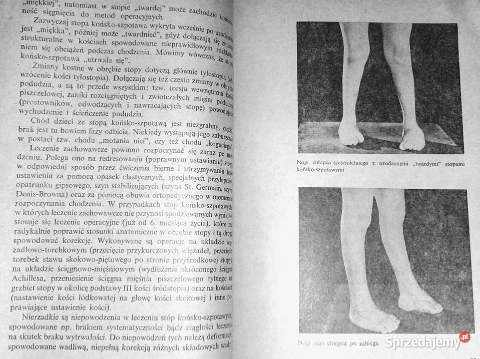 Dziecko kalekie jakiego nie znamy Barbara Chełm