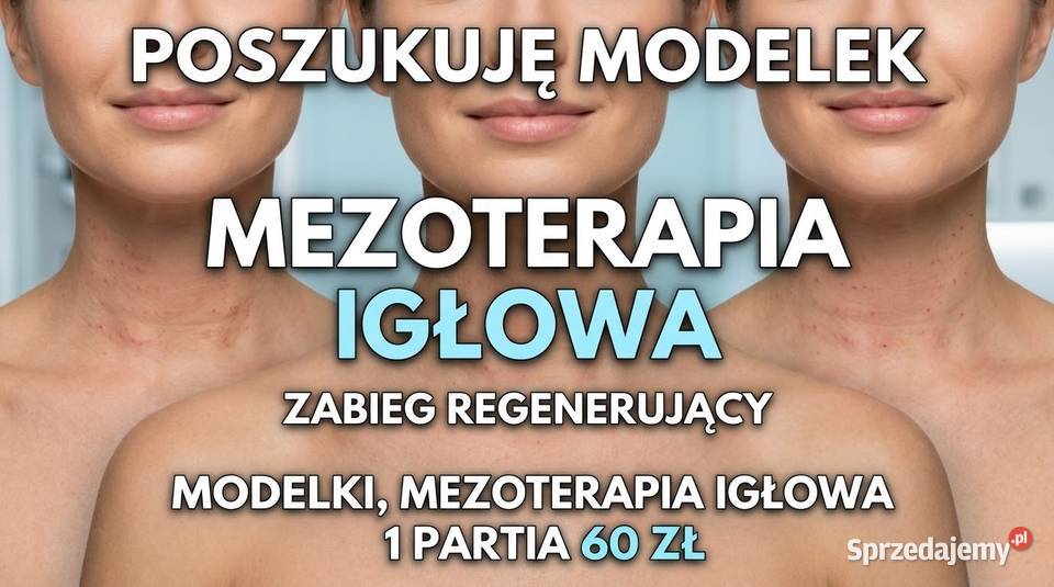Modelki mezoterapia igłowa Kraków