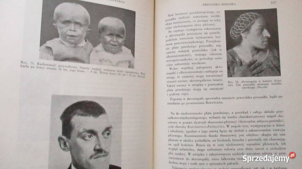 Fizjopatologia ogólna patologia fizjologia łódzkie Łódź