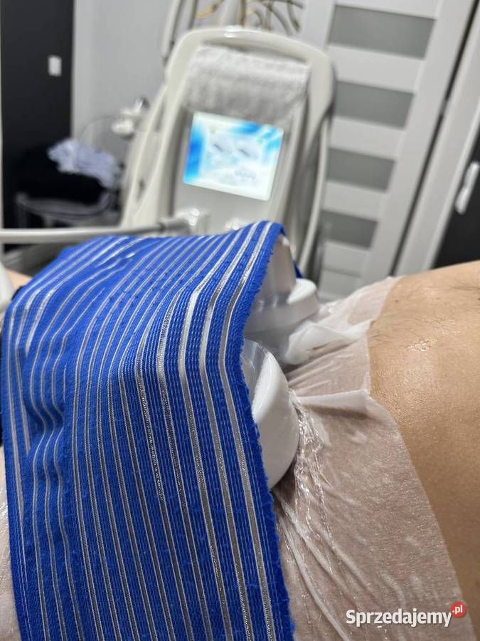Kriolipoliza Fale radiowe urządzenia Fryzjerstwo i kosmetyka Filipowice