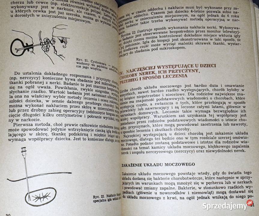 Choroby nerek u dzieci Teresa Wyszyńska Pozostałe