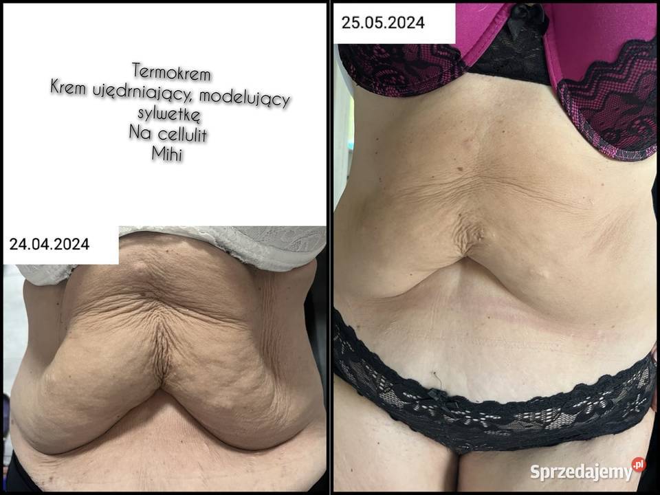 Termokrem ujędrniający Skuteczna pielęgnacja Dla kobiet Hajnówka