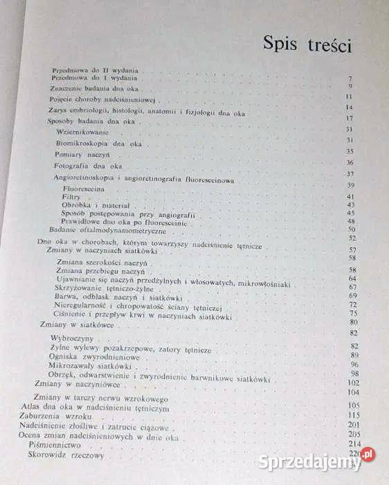 Dno oka w nadciśnieniu tętniczym Edward Bryk Chełm