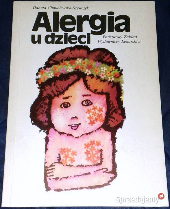 Alergia u dzieci Danuta ChmielewskaSzewczyk Chełm