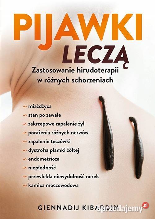 Pijawki leczą Zastosowanie hirudoterapii w