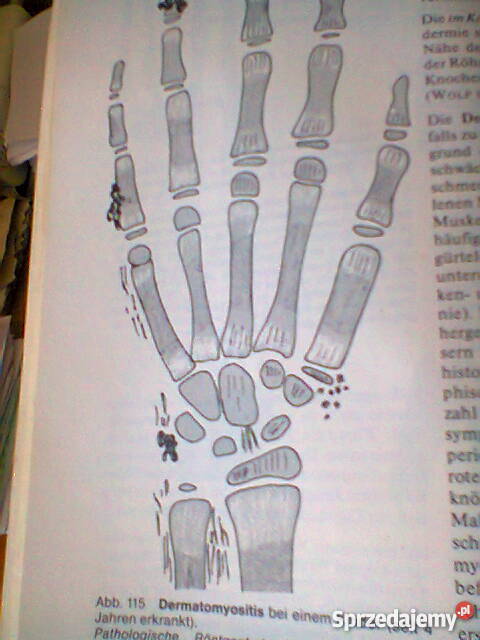 Gelenke Wirbelverbindungen Szczecin sprzedam