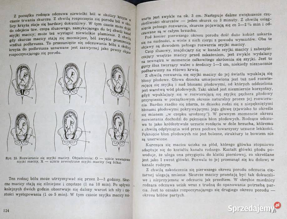 Ciąża poród połóg Stanisław Radowicki Pozostałe Chełm