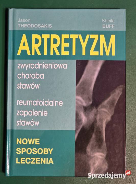 Artretyzm Jason Theodosakis Sheila Buff 2008r Gryfice