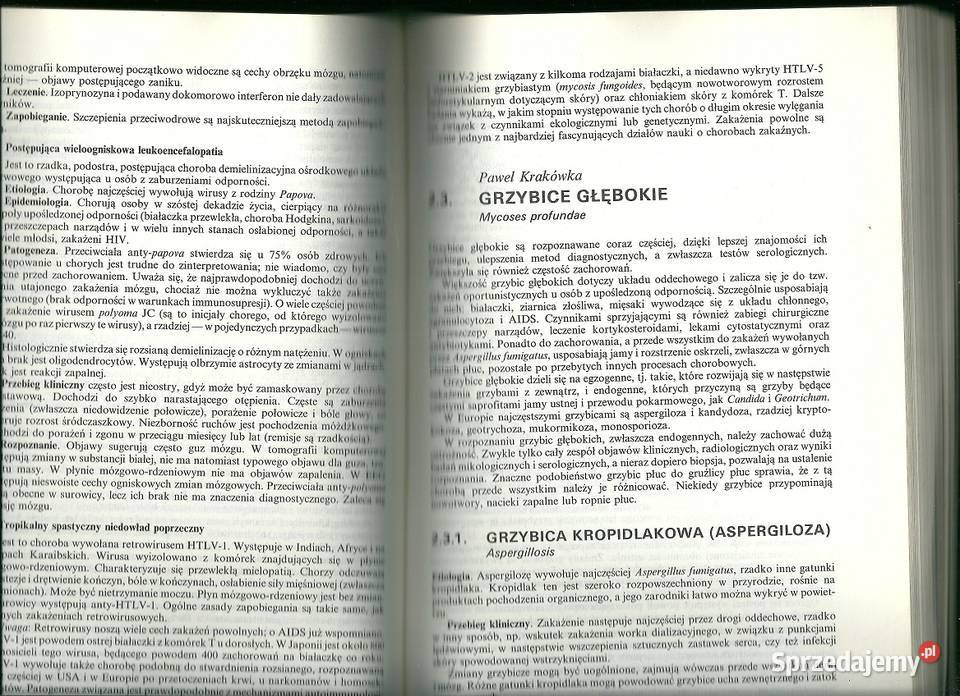 Zarys kliniki chorób zakaźnych podręcznik Książki naukowe i popularnonaukowe