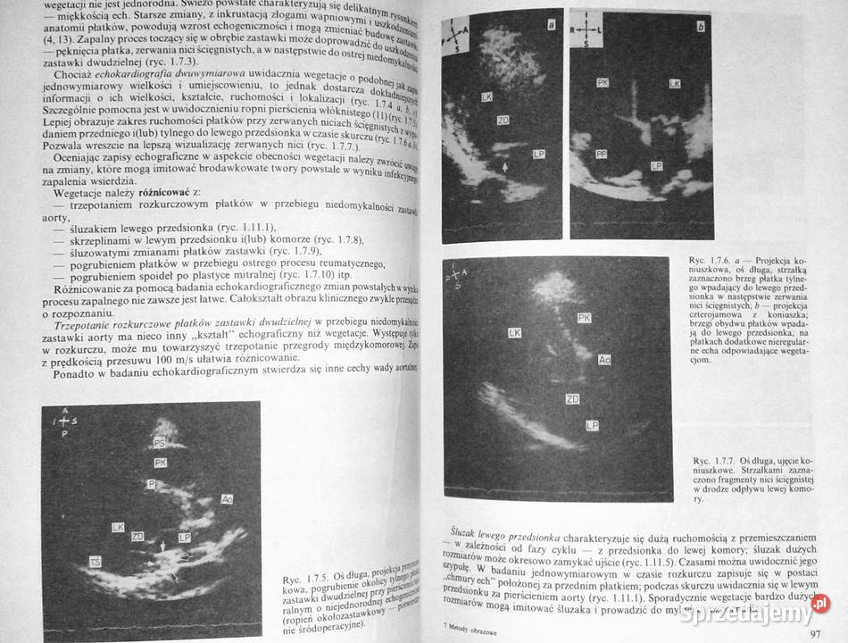 Metody obrazowe w diagnostyce chorób układu Chełm
