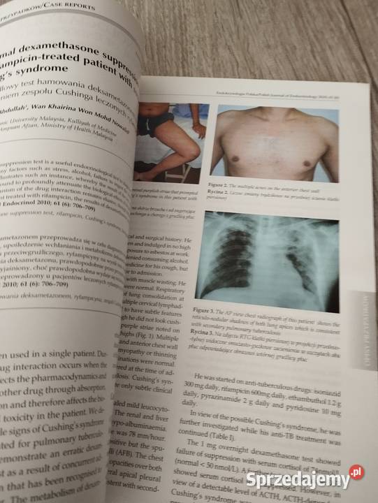 endokrynologia polska czasopismo Poznań