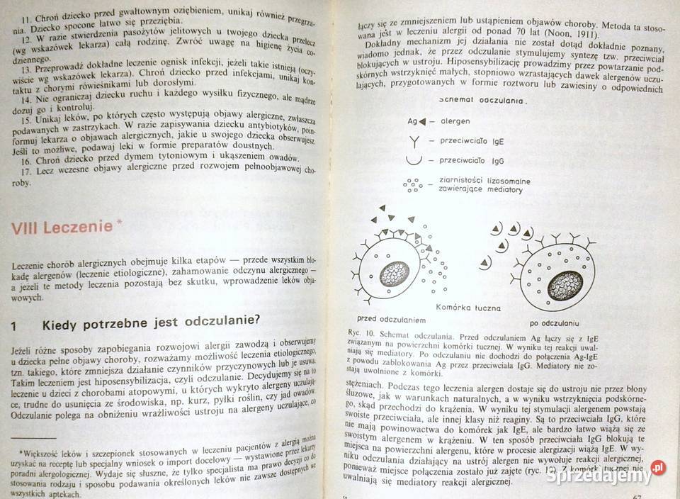 Alergia u dzieci Danuta ChmielewskaSzewczyk sprzedam