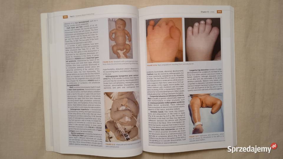 Medical Embryology Sadler Warszawa sprzedam