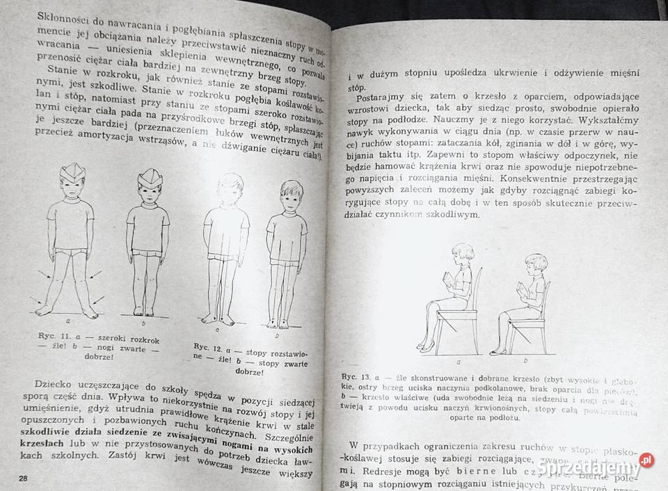 Stopy płaskie u dzieci gimnastyka lecznicza lubelskie