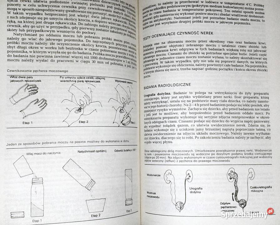 Pielęgnowanie chorych dzieci E Fenella St J Chełm sprzedam