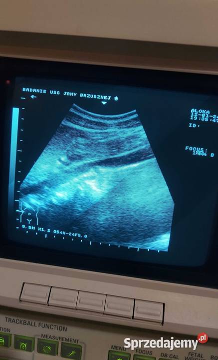 Zestaw USG ALOKA SSD500 Radom