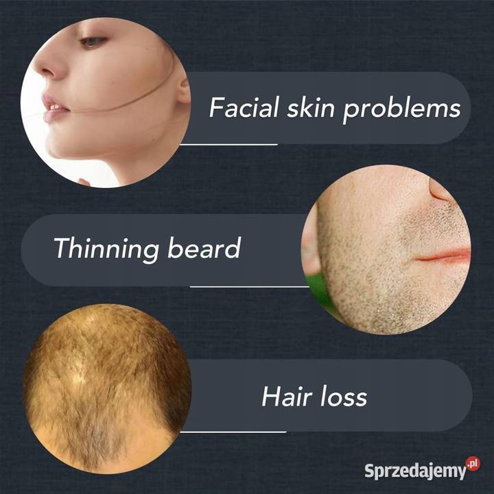 Derma Roller do stymulowania skóry włosów i Sosnowiec