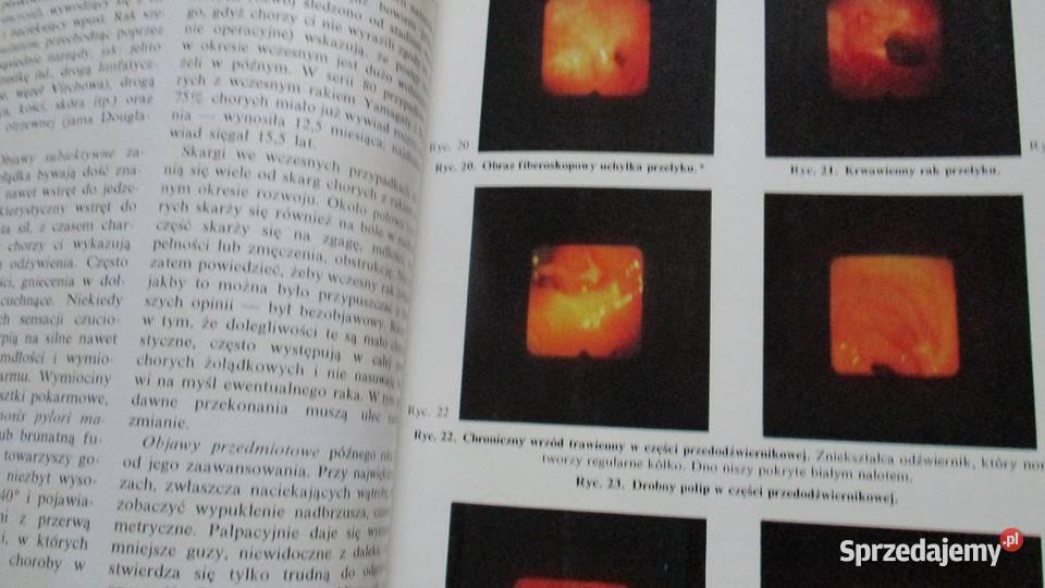 Nauka o chorobach wewnętrznych Orłowski