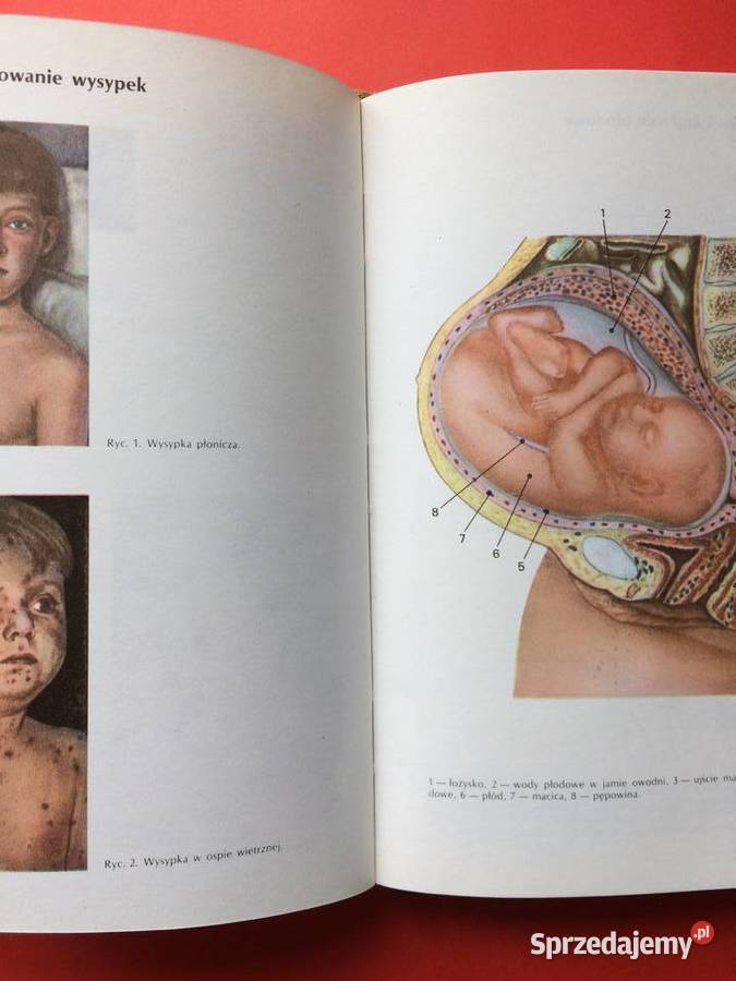 2588 Encyklopedia Zdrowia Dziecka Szczecin sprzedam