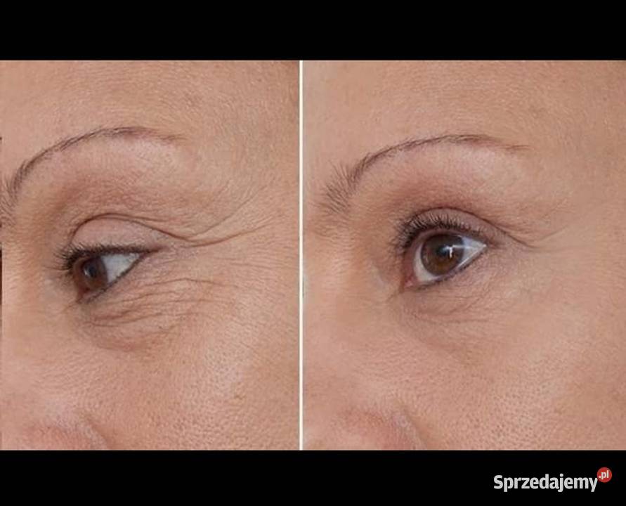LARENS LipoColl HA Hydro Serum Pielęgnacja Dla kobiet warmińsko-mazurskie Działdowo sprzedam