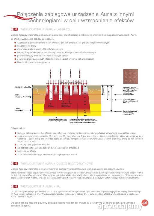 Thermolifting IR AURA alternatywa Zaffiro Dwie Prudnik