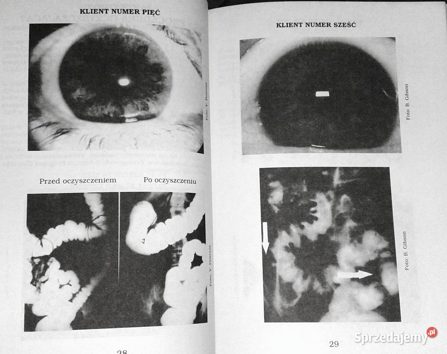 Czyszczenie okrężnicy Jennifer Weiss Pozostałe Chełm