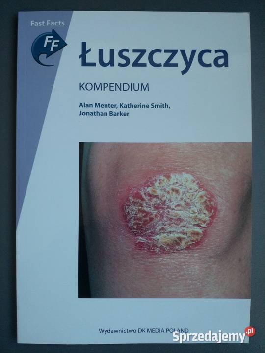 Łuszczyca Kompendium A Menter J Barker K Smith Gdańsk