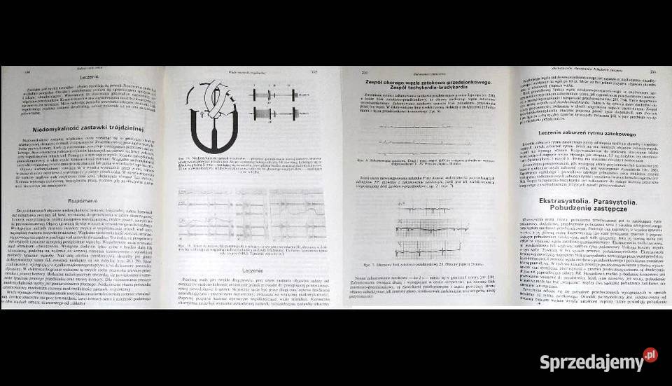 Zarys kardiologii Henryk Chlebus Włodzimierz Chełm