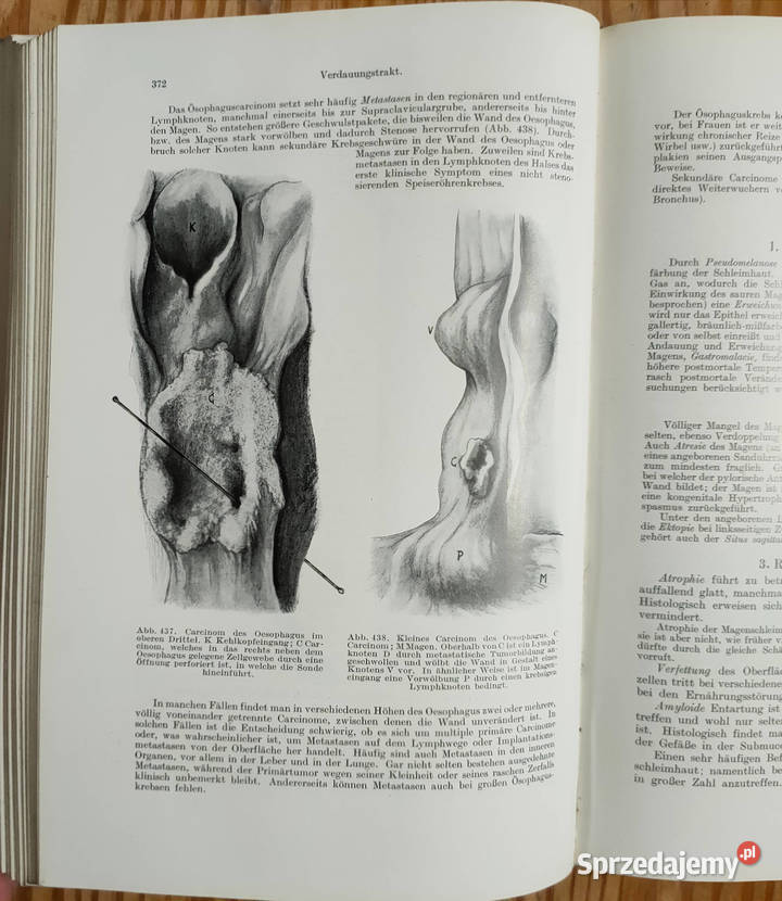 Lehrbuch der allgemeinen pathologie und der Sosnowiec