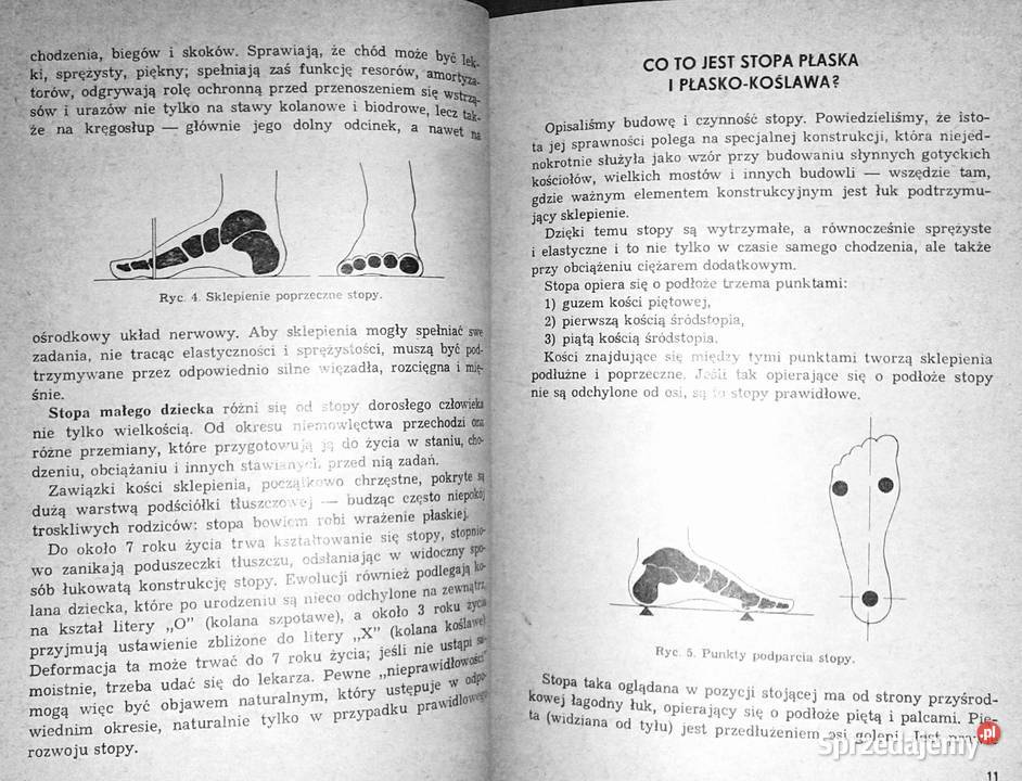 Stopy płaskie u dzieci gimnastyka lecznicza lubelskie Chełm