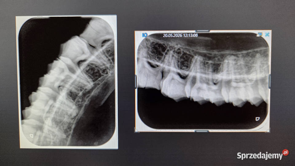 Skaner płytek obrazowych RTG Sirona Dentsply Urządzenia